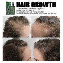 (30ml) New model Jaysuing Hair Care Liquid Strong Hair To Prevent Hair Root Massage Nourishing Liquid Thick Scalp 6453738731373