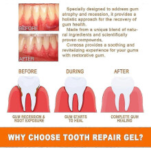 (14pcs x 1.5ml) Gum Repair Treatment Ampoules, Toothpaste Gum Therapy Essence, Oral & Gum Restore Ampoule Essence Gentle Teeth Whitening
