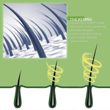 Ouhoe Hair Care Rosemary Oil Prevents Hair Loss, Nourishes And Strengthens Hair. Hair Care Essential Oil
