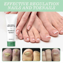 Nail Fungus Treatment Gel, 2pcs 20ML Natural Nail Repair Strengthening Gel, Fungus Removal, Onychomycosis Repair