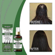 (2) 2026*1-5x Rosemary Hair Care Oil_voke