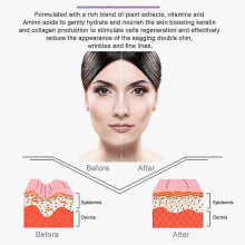 (1 box) 1-3box Face Chin Lift and Shaping Mask Slimming Lifting Firming Double Chin Treatment Mask Hydration Firm, LiftZZ60