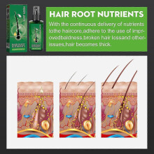 Men's Hair Growth Serum Nourishing Formula for Thicker Hair, Hairline Stabilization Faster Hair Growth | Strengthens Roots, Activates Pigment, Red