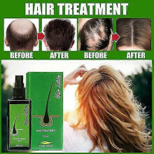 (3 bottles) 3 bottles Hair Regrowth Lotion Haircare Hair Loss Oil Baldness Anti Hair Loss 120ml