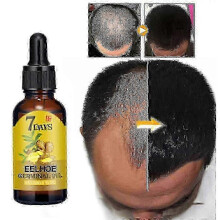(20ML) 2025 Eelhoe Hair Growth Essence Hair Loss Scalp Treatments Ginger Ginseng Raise Dense Hair For Damaged