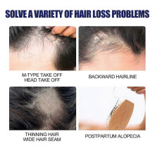 East Moon Men's Dense Hair foam Repair Hair Root Hair Follicles Men's Dense Hair Moisturizing foam