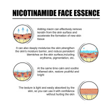 Niacinamide Facial Serum Contains Glycerin, Panthenol, And Sodium Pca