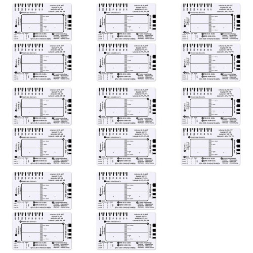 16pcs ECG 7 Step Ruler,ECG 7 Step Ruler for ECG/EKG Interpretation,ECG Reference Guide Ruler,EKG Calipers Measuring Tool