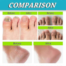 1-3Pcs Deodorant Foot Spray 30ml Natural Odor Remover Stinky Feet Skin Care Deodorant Supplies Spray
