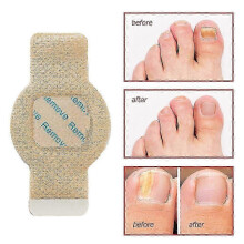 (4Bags) Oenail Fungus Patch Waterproof Nail Repair Patches Nail Ingrown Correction Stickers 1/2/3/4/5pcs For Discolored Or Damaged Nails_usmddsa