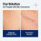 PDRN Lifting Serum με σκουαλάνιο Ορός Προσώπου Σύσφιξης Δέρματος Βαθιά Ενυδάτωση 4