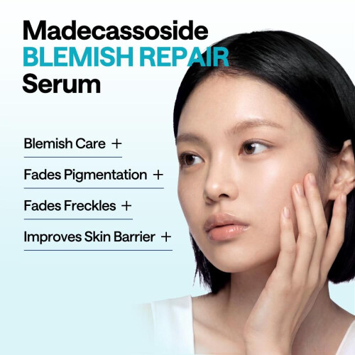 Madecassoside Calming Serum Ορός Προσώπου για την Περιποίηση Ατελειών, Εξασθενίζει τι 2