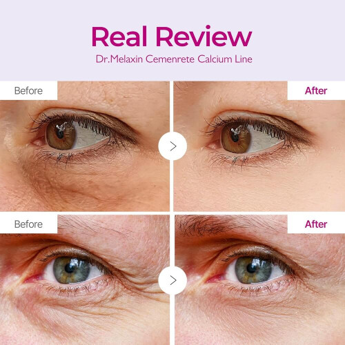 πακέτο Cemenrete Calcium Volume Eye Patch για χαλάρωση κάτω από τα μάτια, μάσκα ματιών γ 2