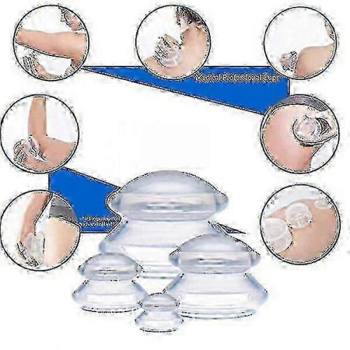 Cupping for Full Body Massage 4-pack (l-xs) White-Qhzl 1