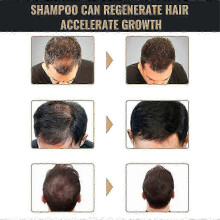 (3bottles) 25-26 1-3x SPARTAN Root Activator ShampooAntiSparse Nourishing Scalp Shampoo Hair Care