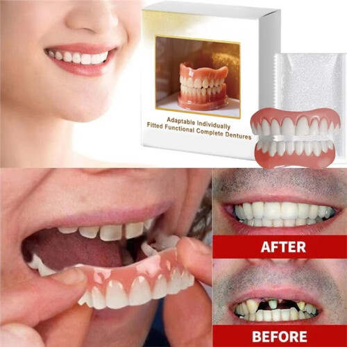 3Pcs Denture Resin Kit - Soft Kit Teeth Upper and Lower Set - Resin Liners Soft Denture Kit - Easy Use 2