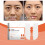 Hydrolyzed Collagen Nasolabial Patch Moisturizing Firming 2 4