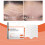 Hydrolyzed Collagen Forehead Patch 2ml 4