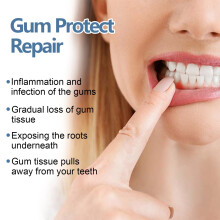 Gingival reparationsblekningsmedel 4 ml