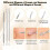 Blackhead Remover Tool Set Stainless Steel 20 pcs 3