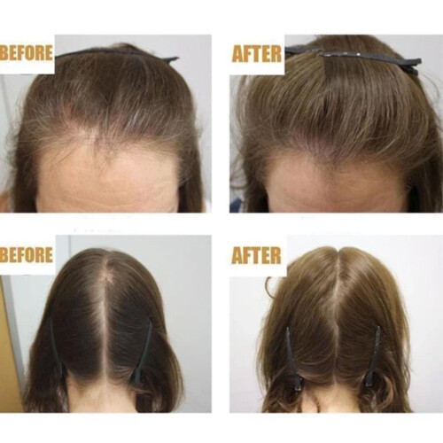 Deep Conditioner for Damaged Hair 30ml  2 2