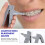 Tandligatuurringdispenser (1 stuk) 4