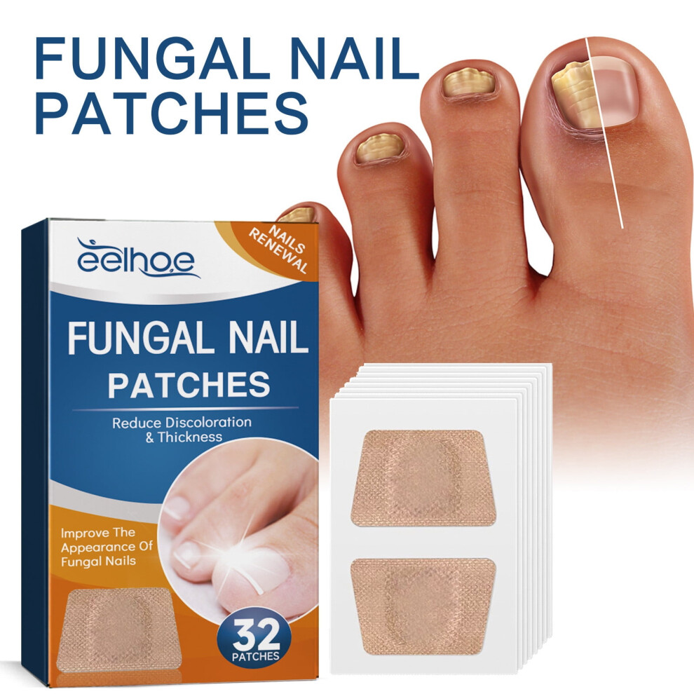 Ingrown Toenail Correction Stickers Glue-Free 32pc