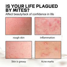 Aurora Mite-Removing Soap for Deep Cleansing