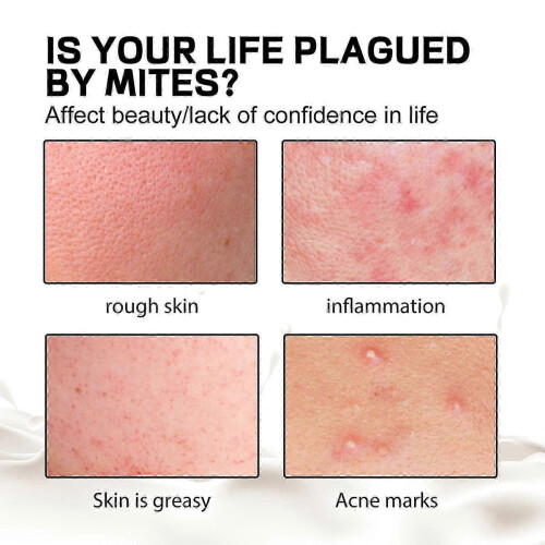 Aurora Mite-Removing Soap for Deep Cleansing