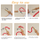 Punch Needle Embroidery Kit with Wooden Handle Tool and Big 5