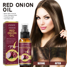 (1 PCS) Red Onion Essential Oil Hair Spray Rice Water Moisturizing 1/3/5PCS Hair Care Repair Damaged Hair