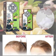 3Pcs Ginger Plant Extract Anti-hair Loss Hair Shampoo, 2025 New Ginger Plant Extract Anti-hair Loss Hair Shampoo, Ginger Shampoo for Hair Growth