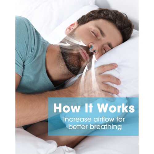 Soft Silicone Nose Vents Anti-Snoring Dilators 4-Pack 1