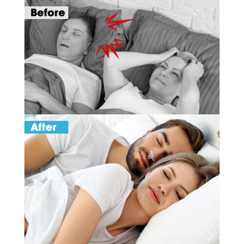 Soft Silicone Nose Vents Anti-Snoring Dilators 4-Pack 2