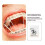 Orthodontic Rubber Bands Light Yellow Pack 3