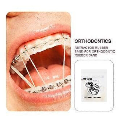 Orthodontic Rubber Bands Light Yellow Pack 2