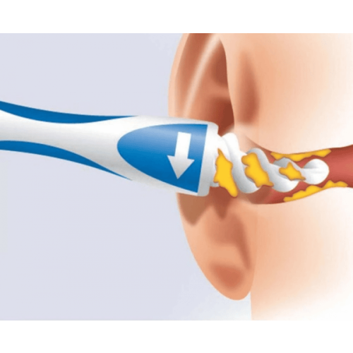 Ear Cleaner Spiral Smart Swab 1 Pack 1