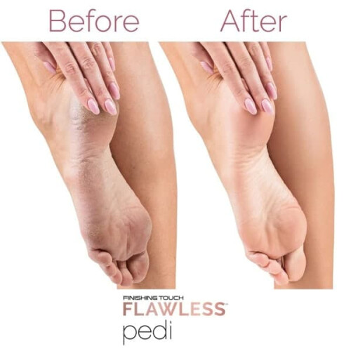 Electric Foot File for Hard Skin - 1 Unit 2