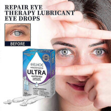 Cataract Treatment Eye Drops Dry Itchy Eyes Fatigue Care Relieve Blurred Vision Treating Redness Eyes Eyesight Improvement Drop