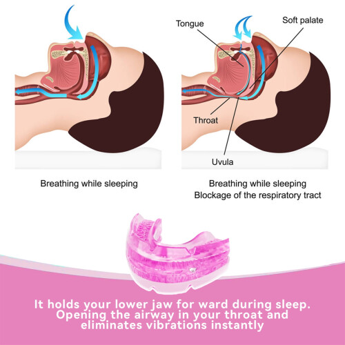 Mouth Guard Adjustable Fit