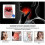 Tonsil Stone Removal Tool for Oral Care Pink 5