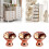 Crystal Drawer Knobs Rose Gold Aluminum Alloy 3 Pack 1