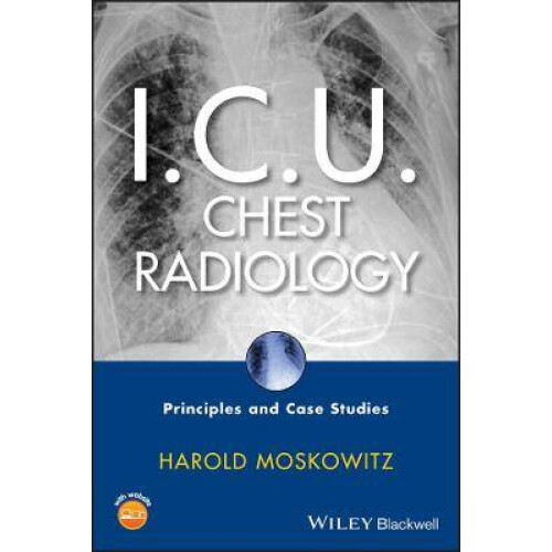I.C.U. Chest Radiology
