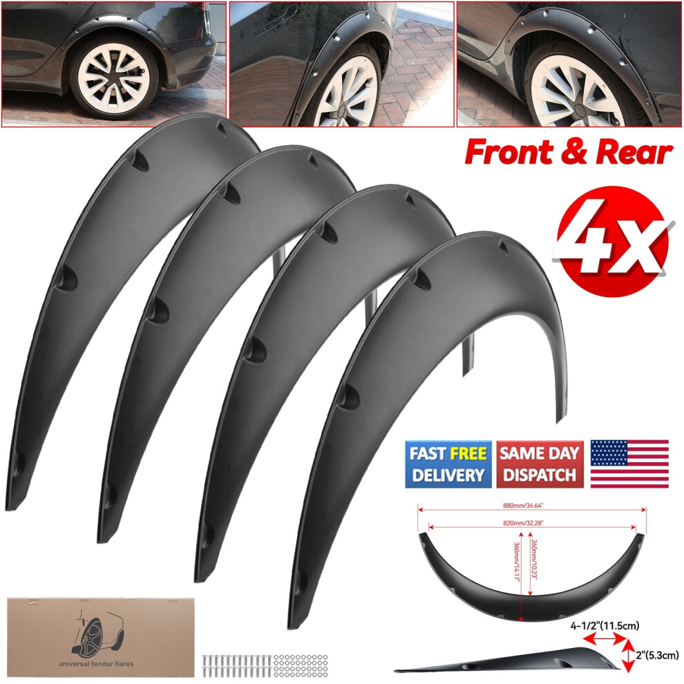 Car Fender Flares Kit 4.5 Inch 4 Pieces 9101399819936