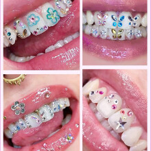 DIY Tooth Gem Kit with Multiple Design Inlay Tools for Beauty Enhancement