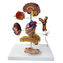 Set di Modelli per Diabete di Tipo Ii, per L'Educazione All'Anatomia Umana e Alla Fisiologia, Modelli Anatomici per Lo Studio Medico