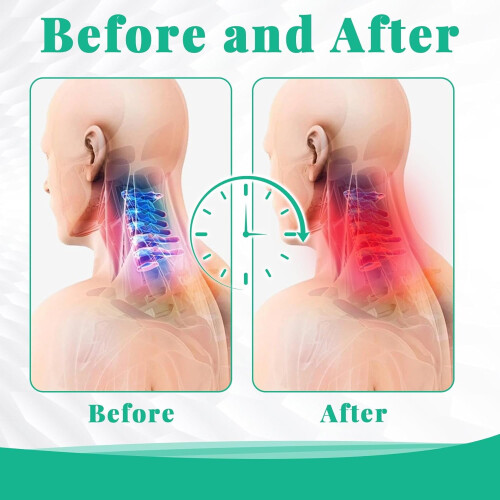 Massageador de pescoço Vitality Magic Pro 2.0 com 4 cabeças, 3D e 8 modos. 2
