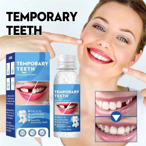 Comprehensive Temporary Filling Tool - Ideal for Filling Gaps Between Teeth and Repairing Broken Teeth. 1