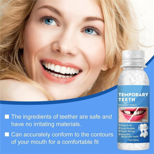 Comprehensive Temporary Filling Tool - Ideal for Filling Gaps Between Teeth and Repairing Broken Teeth. 2