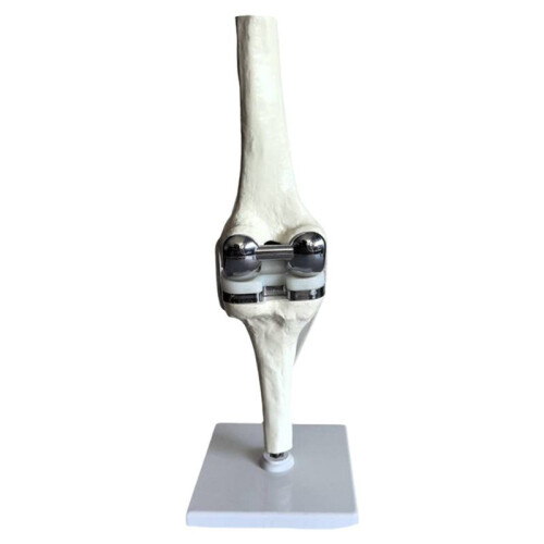 2X Knee Joint Model Simulation Replacement Surgery Meniscus Ligament Cartilages Surgery Model,Artificial Knee Joint 1